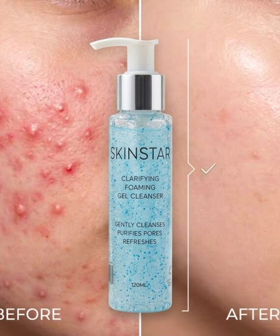 SKINSTAR Facewash Cleanser